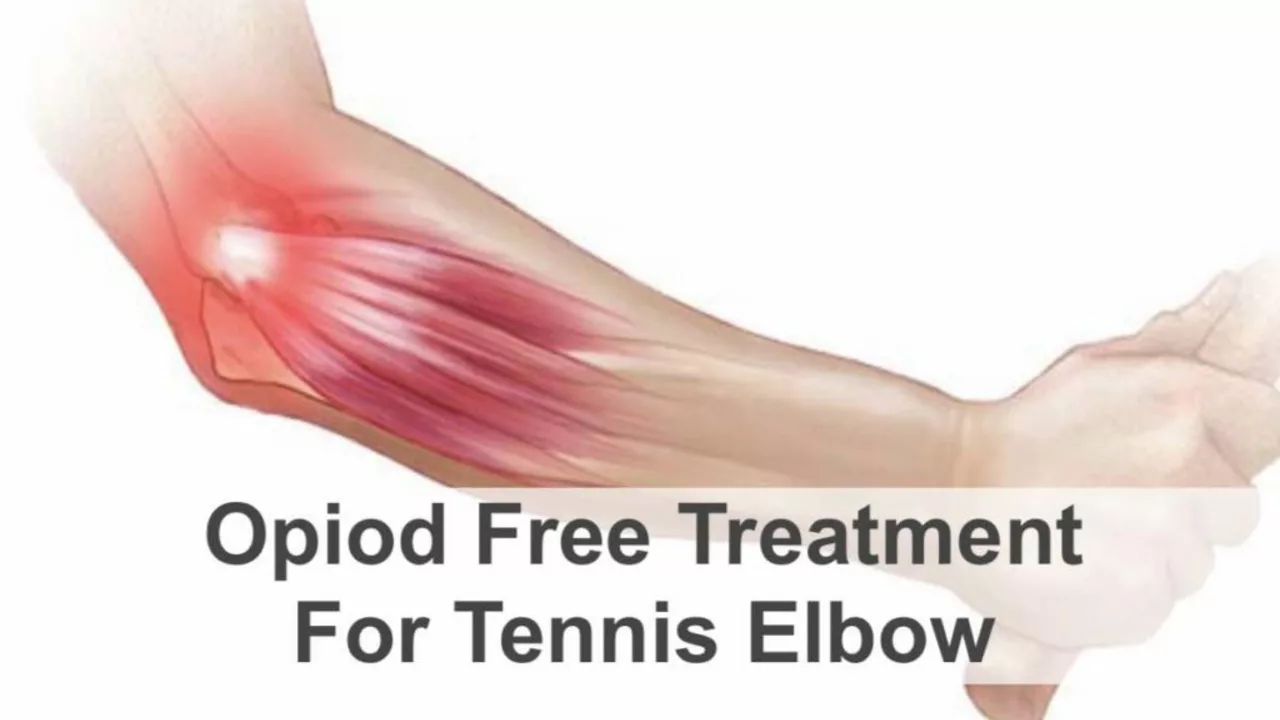 Does dry needling help tennis elbow?